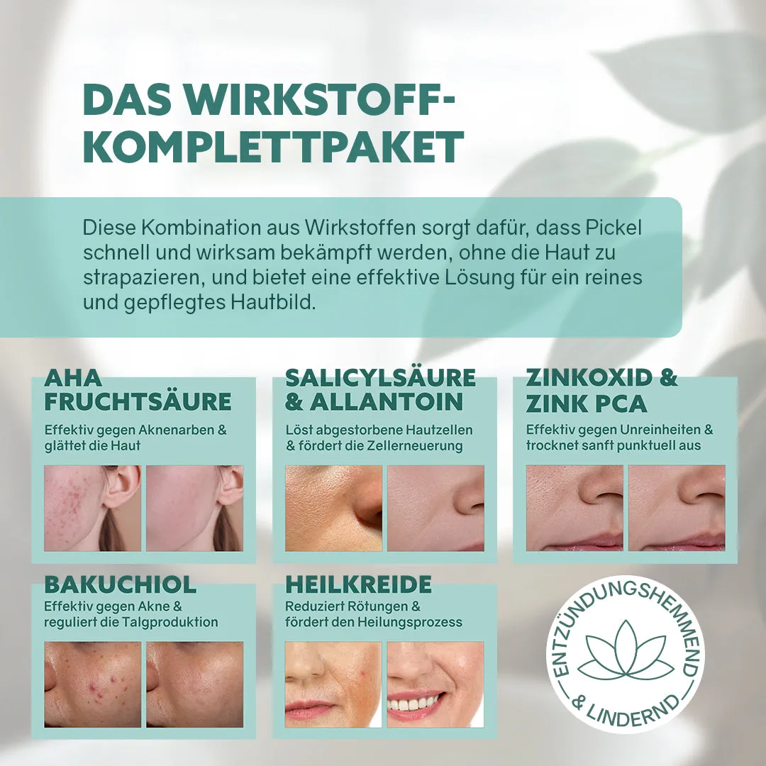 puremetics Precisioner Punktueller Pickellöscher bumsecreme 10 ml