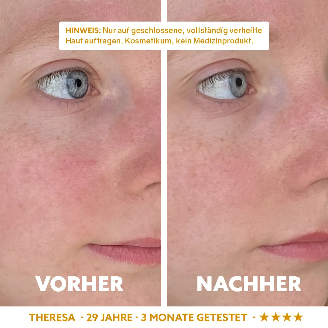 puremetics Dermasoothe serum sensitiv hud 1 stk