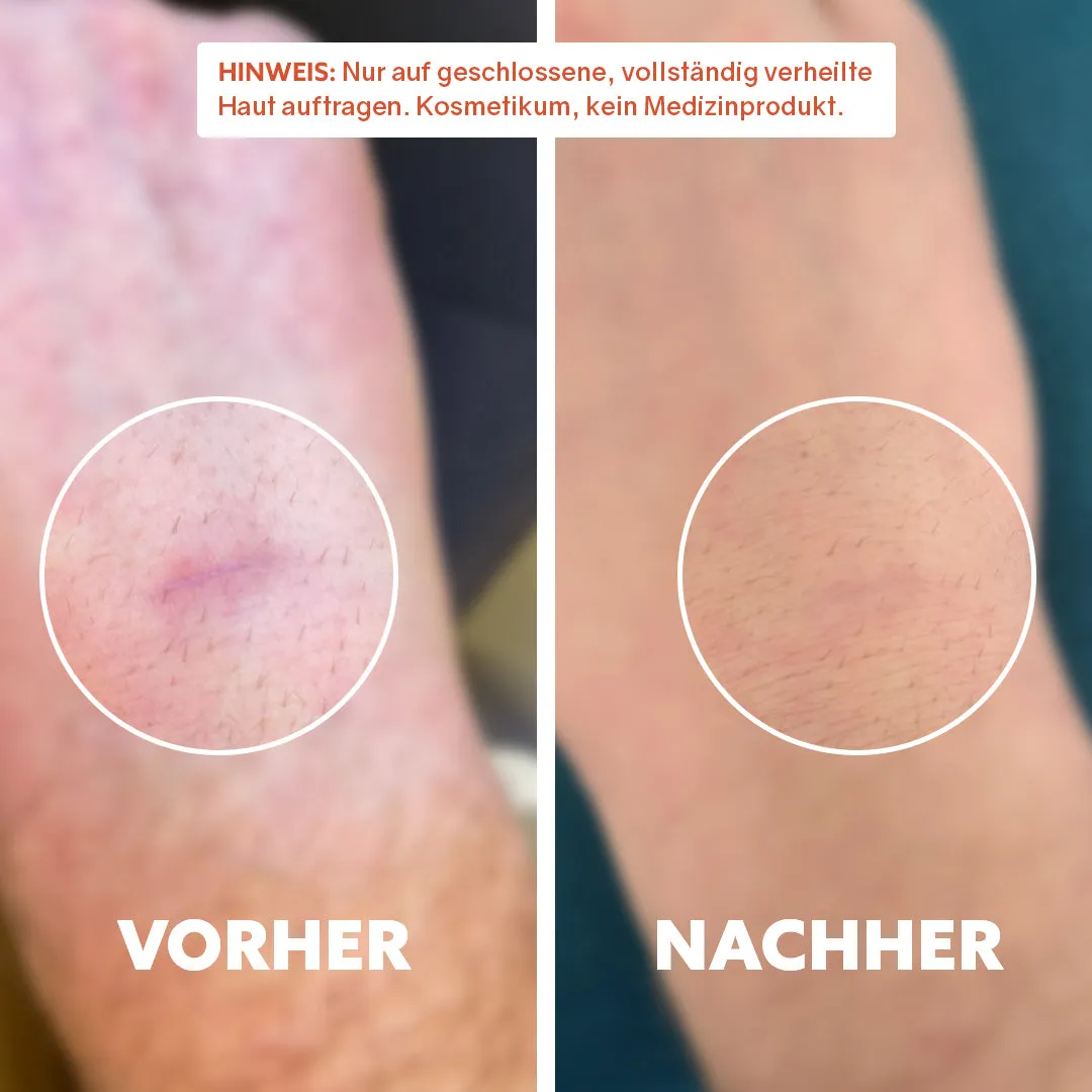 puremetics Pure Repair arolie 90 ml med vildroseolie